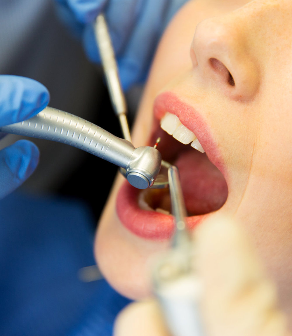 10 Funny dental cleaning fees Quotes Top 9 Tips With dental cleaning fees